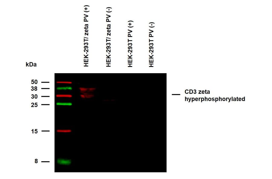 WB - Anti-CD3 zeta (phospho Y72) Antibody [EM-26] (A86536)