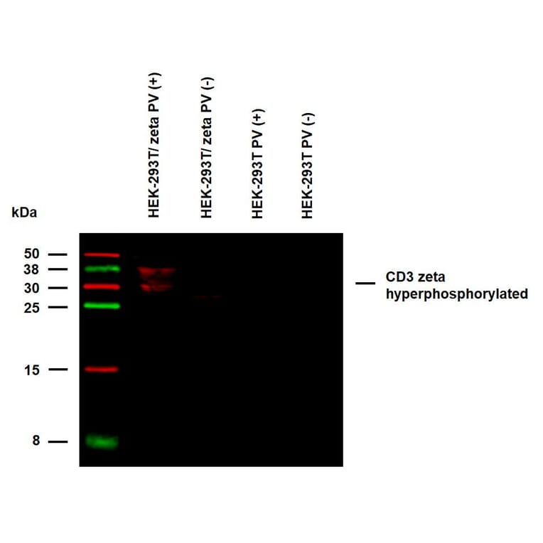 WB - Anti-CD3 zeta (phospho Y72) Antibody [EM-26] (A86536)