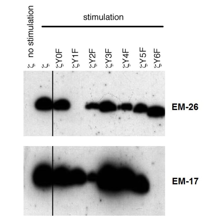 Western Blot - Anti-CD3 zeta (phospho Tyr72) Antibody [EM-26] (A86536) - Antibodies.com