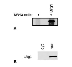 WB - Anti-BRG1 Antibody [BRG-01] (A86541)
