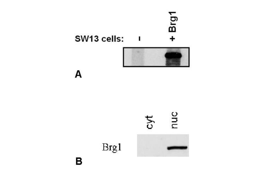 WB - Anti-BRG1 Antibody [BRG-01] (A86541)