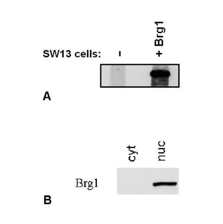 WB - Anti-BRG1 Antibody [BRG-01] (A86541)