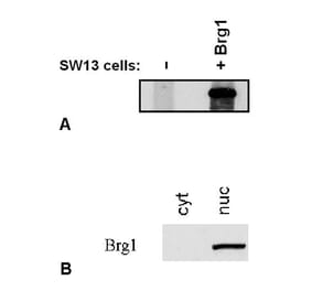 Western Blot - Anti-BRG1 Antibody [BRG-01] (A86540) - Antibodies.com