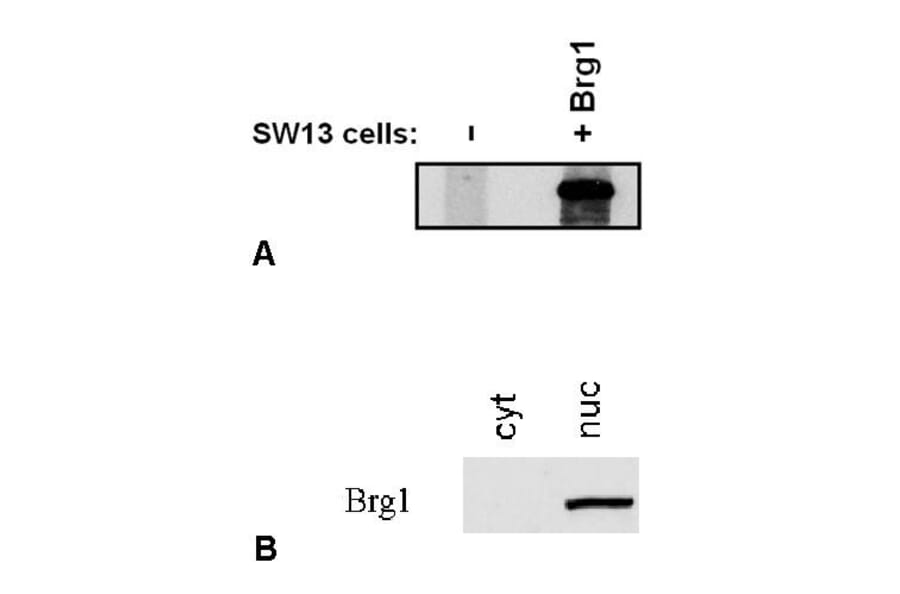 Western Blot - Anti-BRG1 Antibody [BRG-01] (A86540) - Antibodies.com