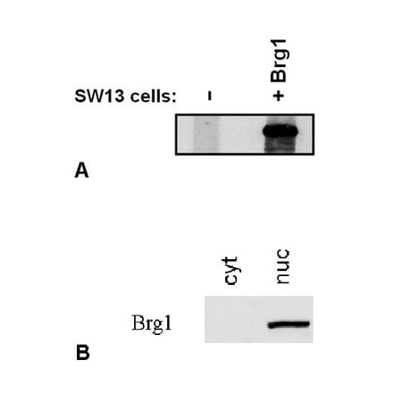 Western Blot - Anti-BRG1 Antibody [BRG-01] (A86540) - Antibodies.com