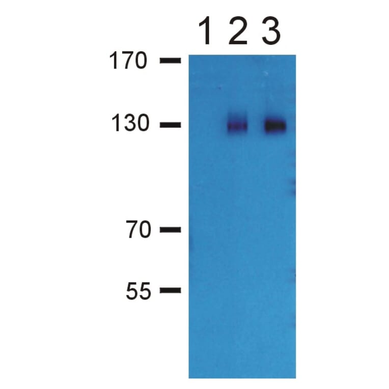 Western Blot - Anti-GABA B Receptor 2 Antibody (A86546) - Antibodies.com