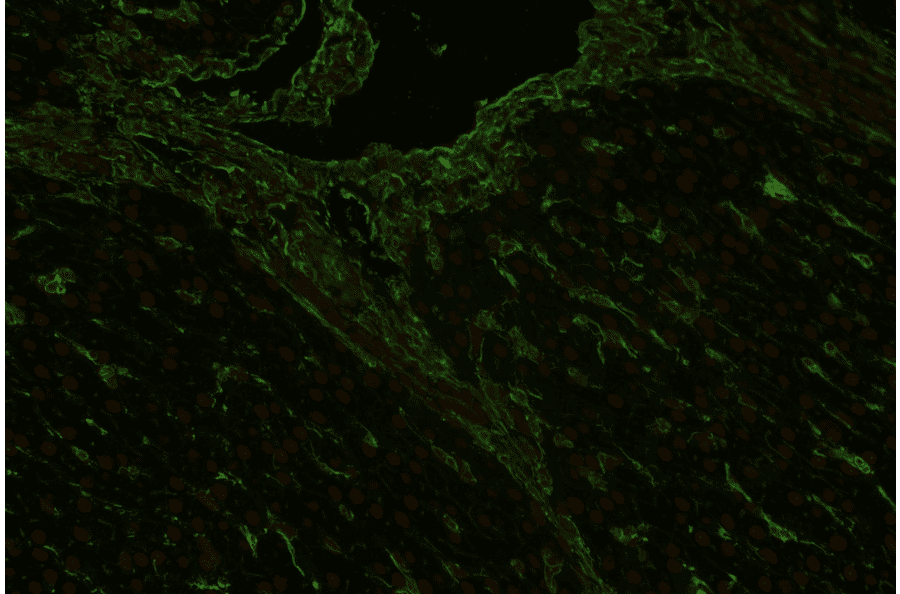 IHC - Anti-Vimentin Antibody [VI-RE/1] (A86554)