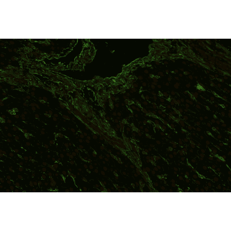 IHC - Anti-Vimentin Antibody [VI-RE/1] (A86554)