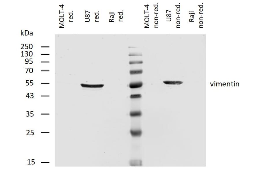 WB - Anti-Vimentin Antibody [VI-RE/1] (A86554)