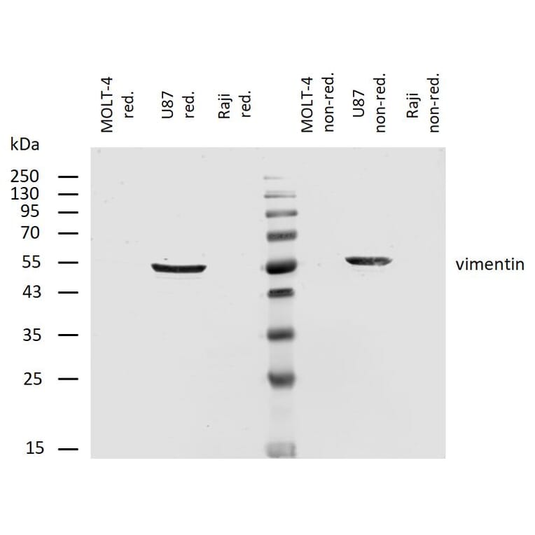 WB - Anti-Vimentin Antibody [VI-RE/1] (A86554)