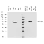 WB - Anti-Vimentin Antibody [VI-RE/1] (A86554)