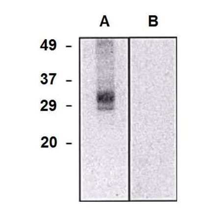 WB - Anti-CLIC5 Antibody [CLIC5-02] (A86556)