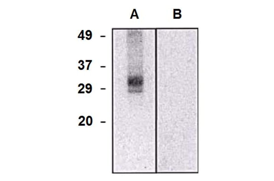 Western Blot - Anti-CLIC5 Antibody [CLIC5-02] (A86552) - Antibodies.com