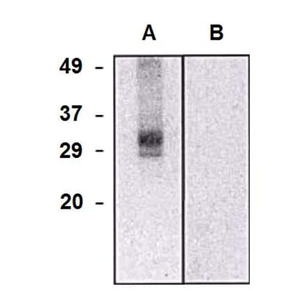 Western Blot - Anti-CLIC5 Antibody [CLIC5-02] (A86552) - Antibodies.com