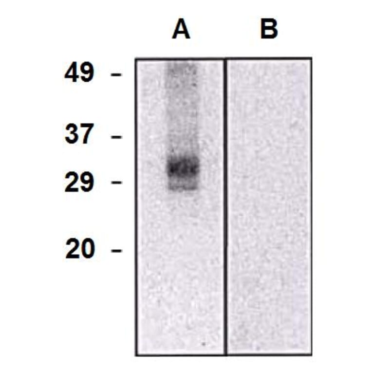 Western Blot - Anti-CLIC5 Antibody [CLIC5-02] (A86552) - Antibodies.com