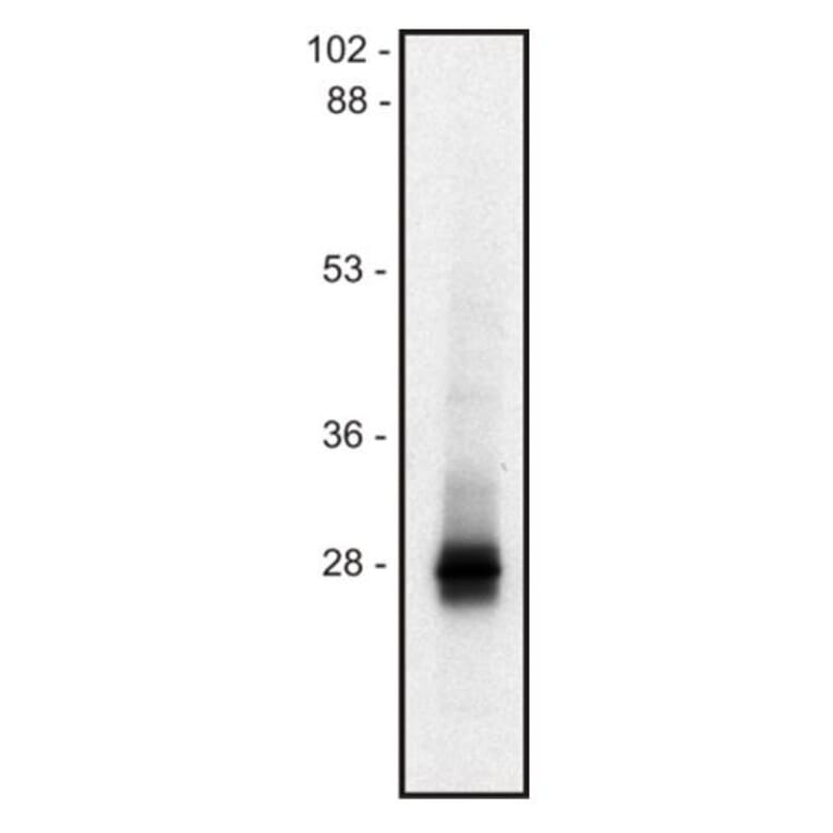 WB - Anti-LIME Antibody [mLIME-05] (A86561)