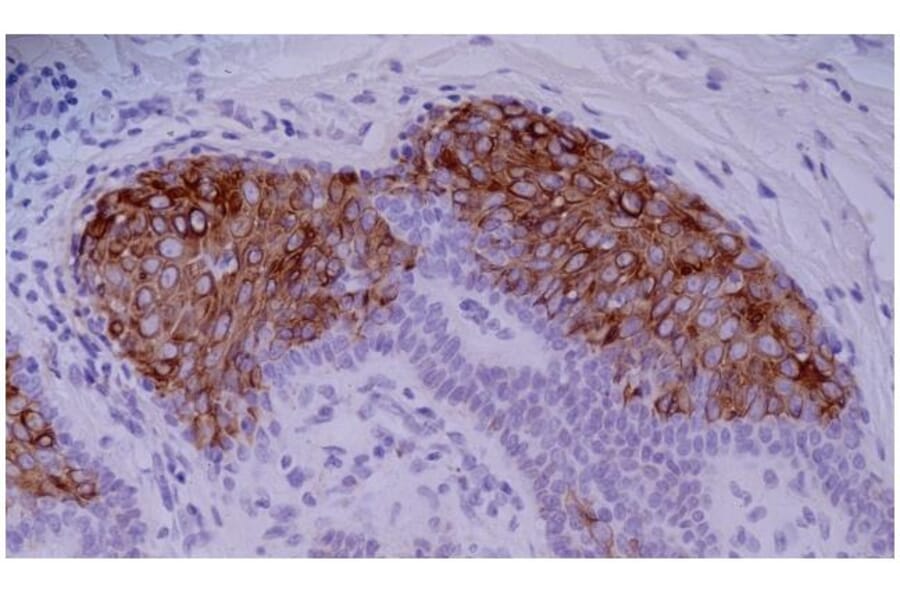 IHC - Anti-Cytokeratin 10 Antibody [VIK-10] (A86570)