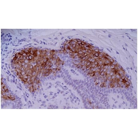 IHC - Anti-Cytokeratin 10 Antibody [VIK-10] (A86570)