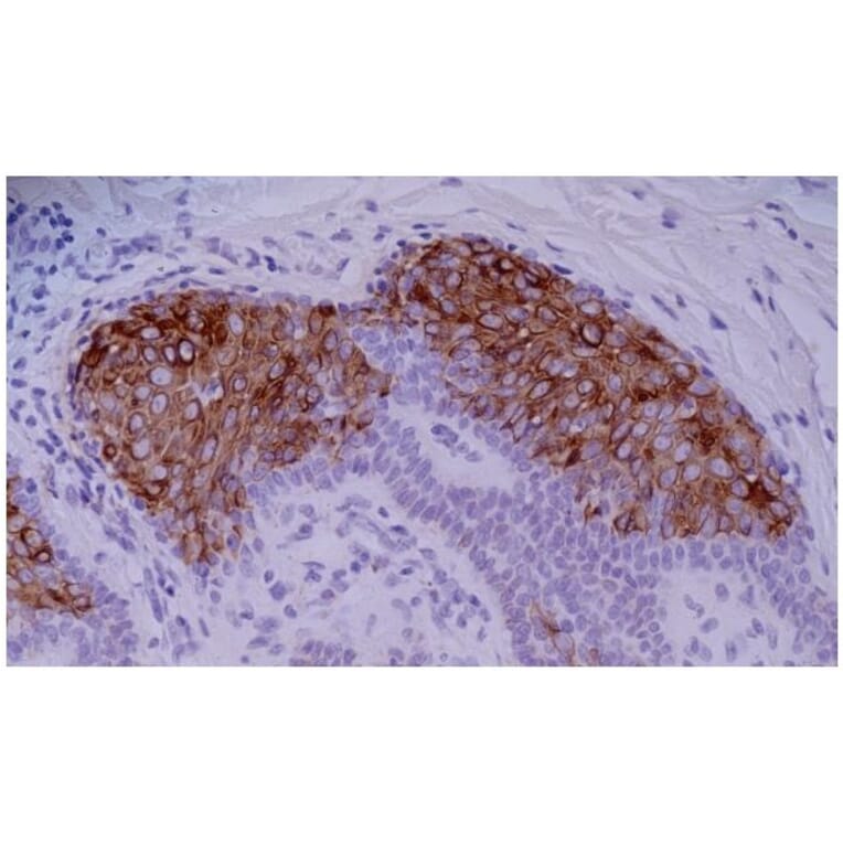 IHC - Anti-Cytokeratin 10 Antibody [VIK-10] (A86570)
