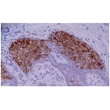 IHC - Anti-Cytokeratin 10 Antibody [VIK-10] (A86570)