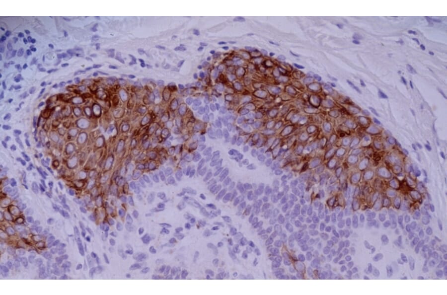 Immunohistochemistry - Anti-Cytokeratin 10 Antibody [VIK-10] (A86565) - Antibodies.com