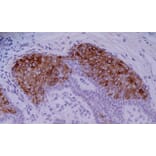 Immunohistochemistry - Anti-Cytokeratin 10 Antibody [VIK-10] (A86565) - Antibodies.com