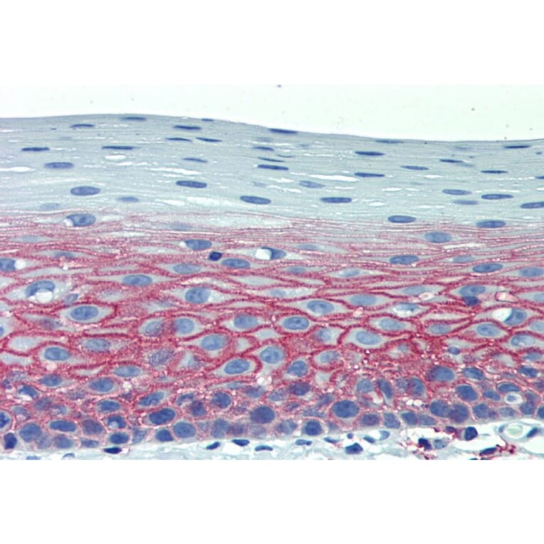 Immunohistochemistry - Anti-CD82 Antibody [C33] (A86571) - Antibodies.com