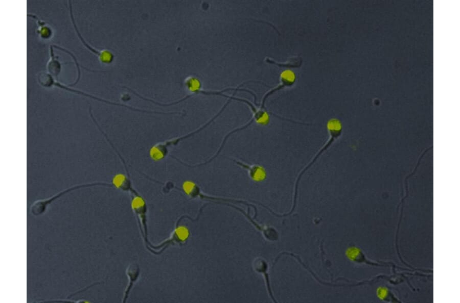 Immunocytochemistry - Anti-VCP Antibody [Hs-14] (A86574) - Antibodies.com