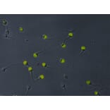 Immunocytochemistry - Anti-VCP Antibody [Hs-14] (A86574) - Antibodies.com