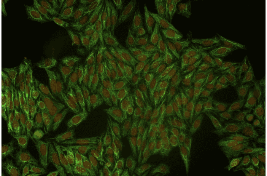 ICC - Anti-Cytokeratin 18 Antibody [DC-10] (A86578)