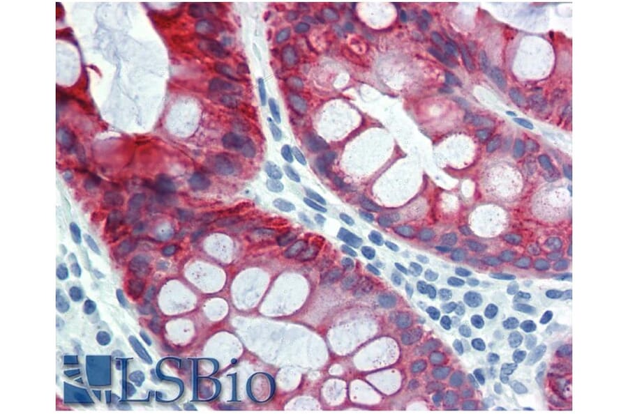 IHC - Anti-Cytokeratin 18 Antibody [DC-10] (A86578)