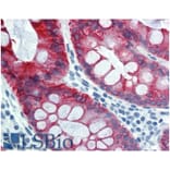 IHC - Anti-Cytokeratin 18 Antibody [DC-10] (A86578)