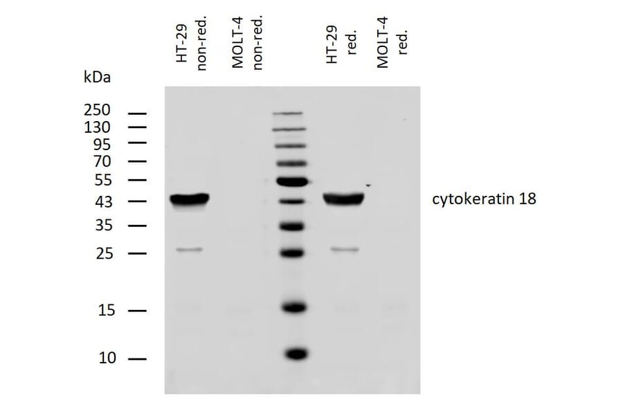 WB - Anti-Cytokeratin 18 Antibody [DC-10] (A86578)