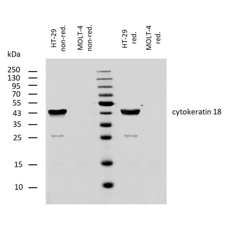WB - Anti-Cytokeratin 18 Antibody [DC-10] (A86578)
