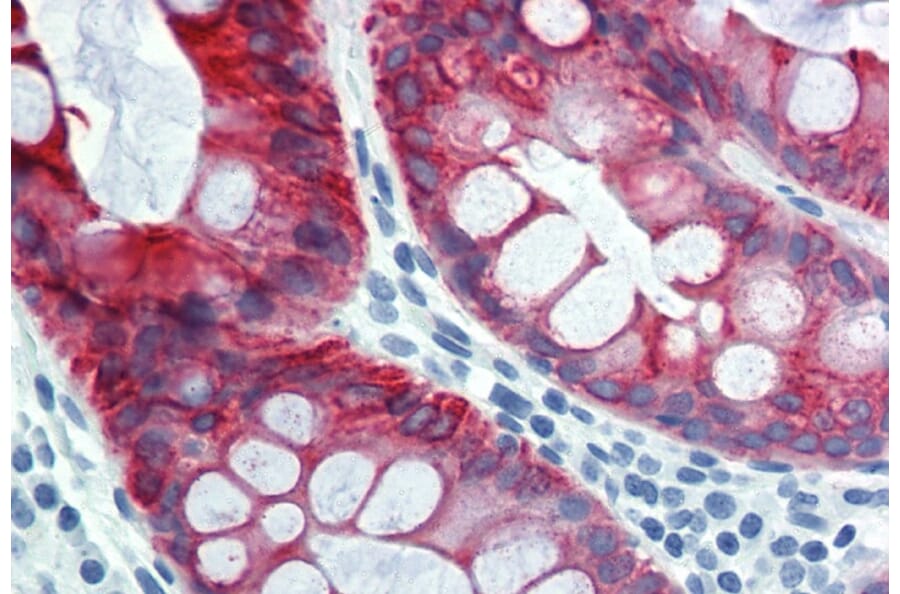 Immunohistochemistry - Anti-Cytokeratin 18 Antibody [DC-10] (A86578) - Antibodies.com