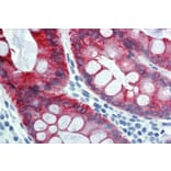 Immunohistochemistry - Anti-Cytokeratin 18 Antibody [DC-10] (A86578) - Antibodies.com