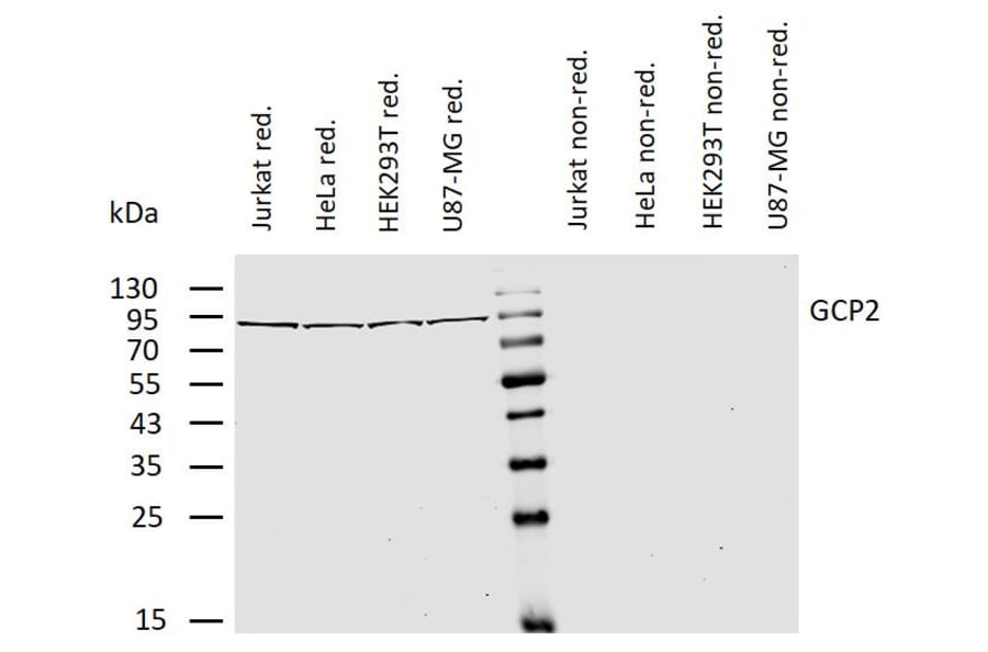 WB - Anti-TUBGCP2 Antibody [GCP2-01] (A86579)