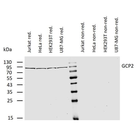 WB - Anti-TUBGCP2 Antibody [GCP2-01] (A86579)