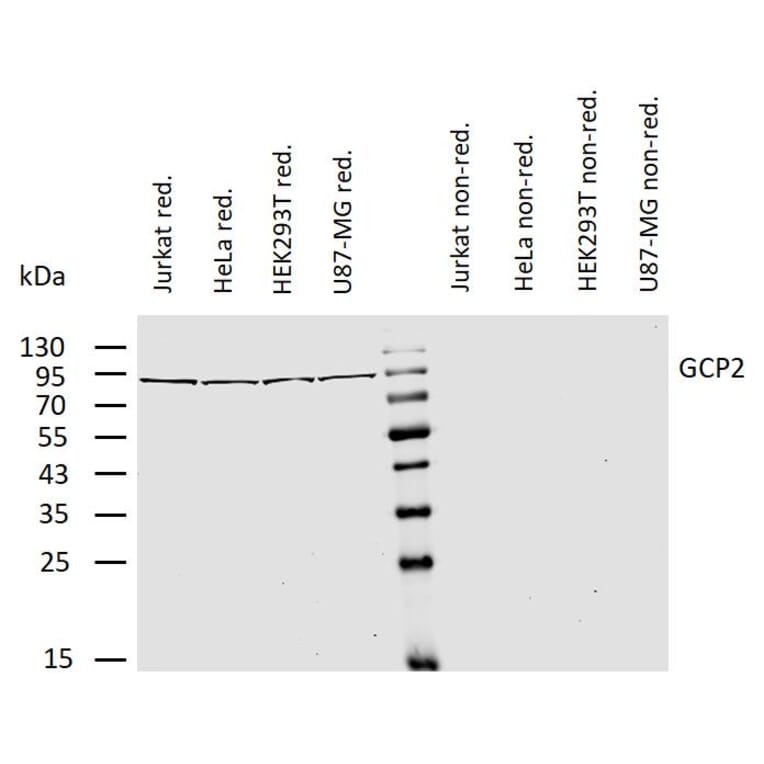 WB - Anti-TUBGCP2 Antibody [GCP2-01] (A86579)