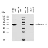 WB - Anti-Cytokeratin 18 Antibody [DC-10] (Biotin) (A86580)