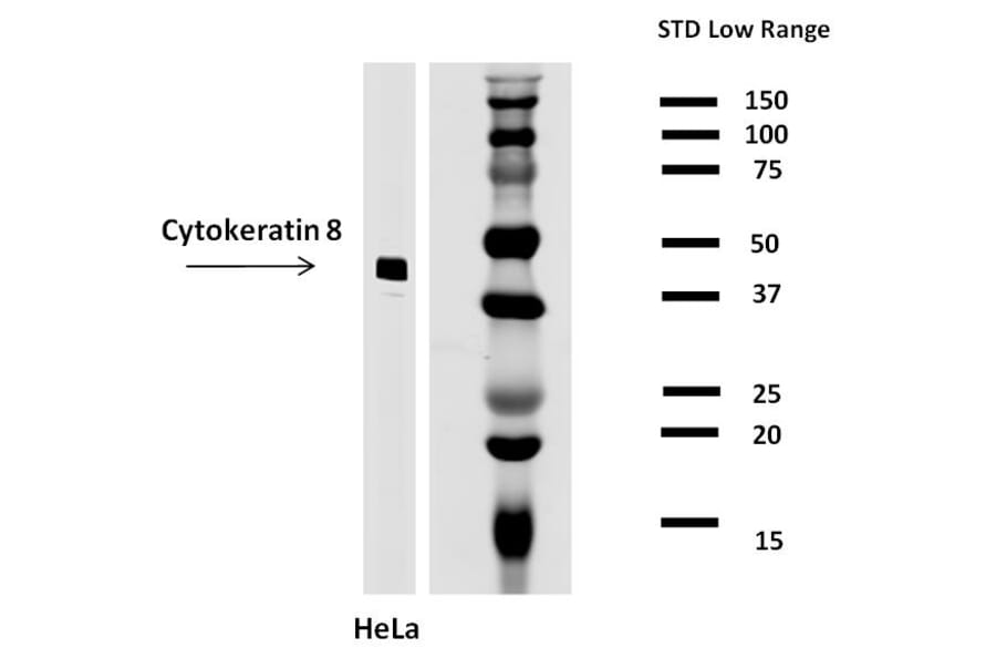 WB - Anti-Cytokeratin 8 Antibody [C-43] (A86582)