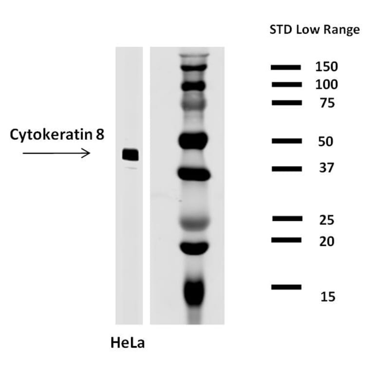 WB - Anti-Cytokeratin 8 Antibody [C-43] (A86582)