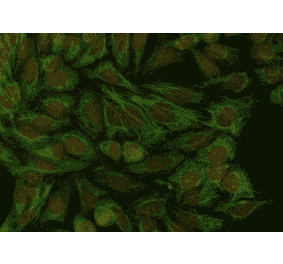 ICC - Anti-Cytokeratin 18 Antibody [DA-7] (A86584)