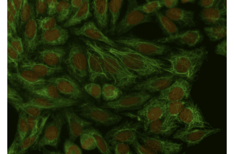 ICC - Anti-Cytokeratin 18 Antibody [DA-7] (A86584)