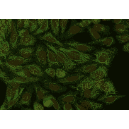 ICC - Anti-Cytokeratin 18 Antibody [DA-7] (A86584)