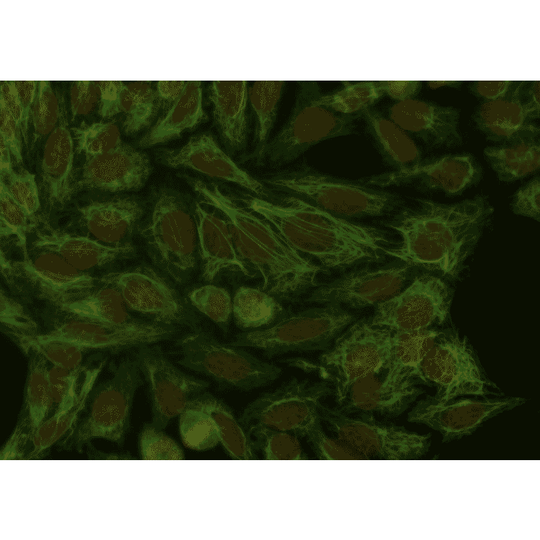 ICC - Anti-Cytokeratin 18 Antibody [DA-7] (A86584)