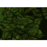 ICC - Anti-Cytokeratin 18 Antibody [DA-7] (A86584)