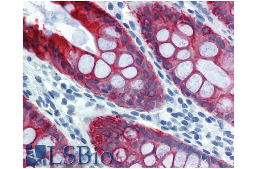 IHC - Anti-Cytokeratin 18 Antibody [DA-7] (A86584)