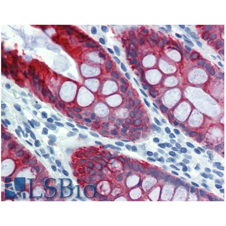 IHC - Anti-Cytokeratin 18 Antibody [DA-7] (A86584)