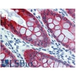 IHC - Anti-Cytokeratin 18 Antibody [DA-7] (A86584)